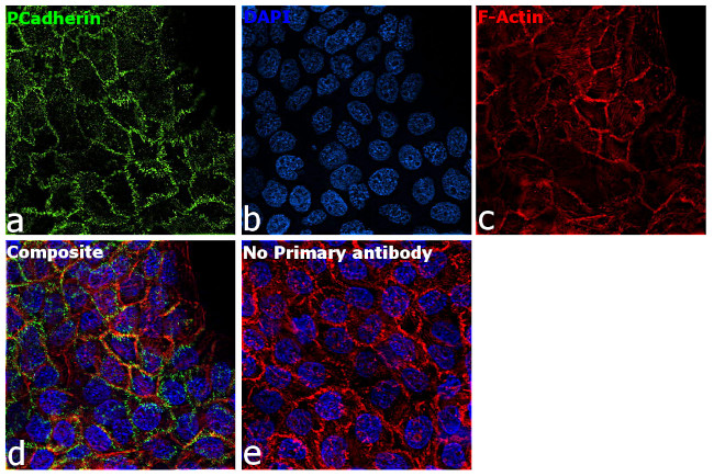 P-cadherin Antibody in Immunocytochemistry (ICC/IF)