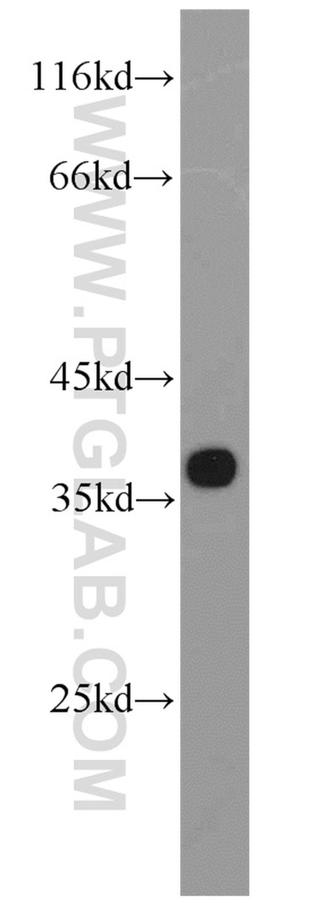 Syntaxin 4 Antibody in Western Blot (WB)