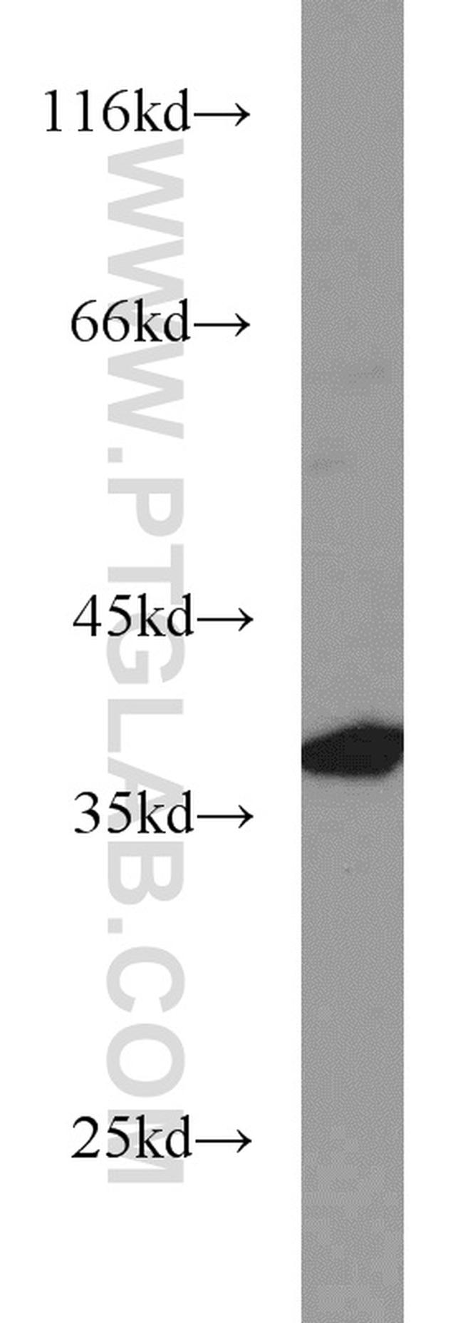 Syntaxin 4 Antibody in Western Blot (WB)