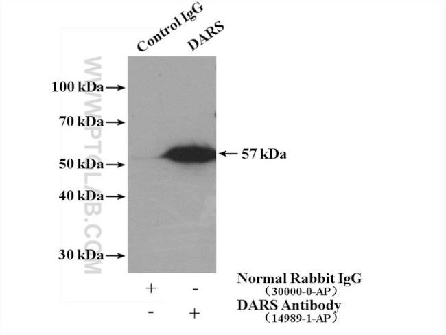 DARS Antibody in Immunoprecipitation (IP)