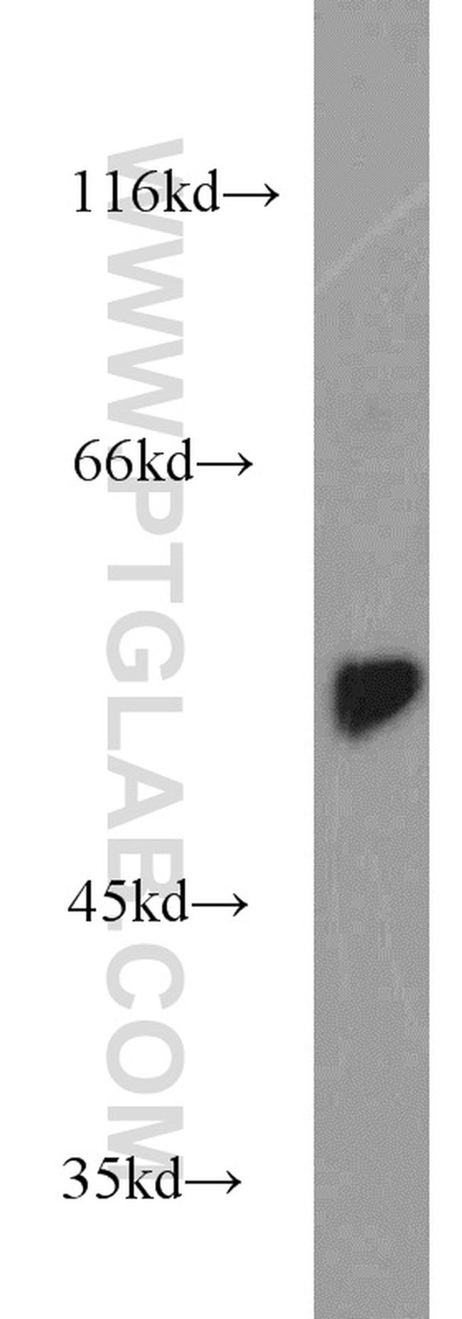 DARS Antibody in Western Blot (WB)