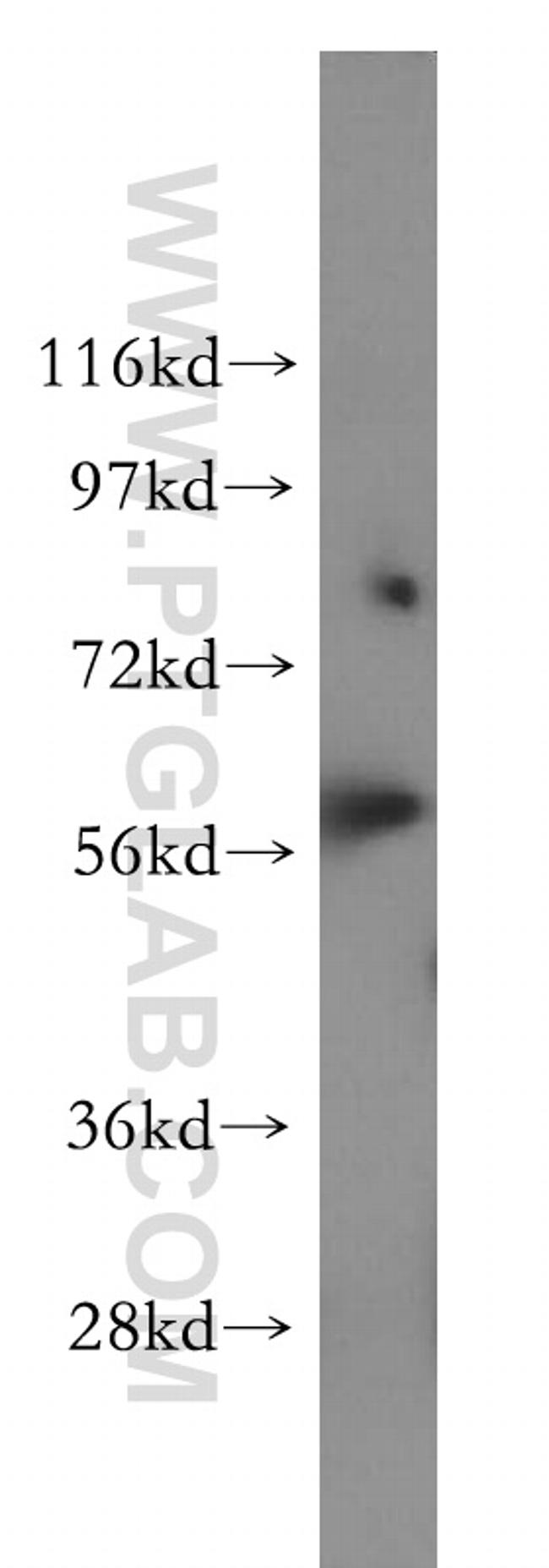 DARS Antibody in Western Blot (WB)