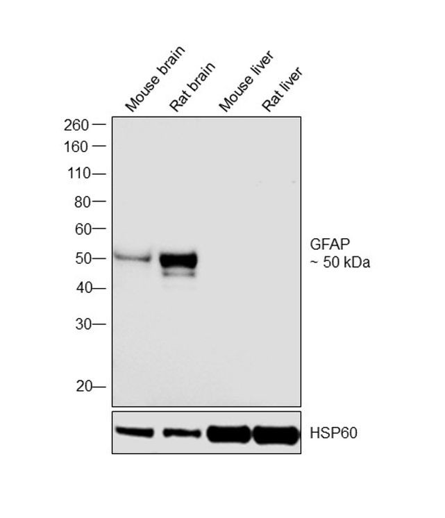 GFAP Antibody