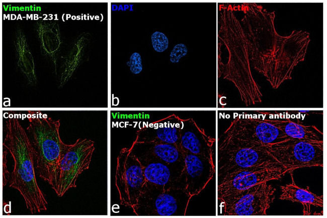 Vimentin Antibody