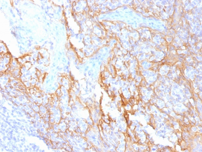 Catenin, beta (p120) Antibody in Immunohistochemistry (Paraffin) (IHC (P))