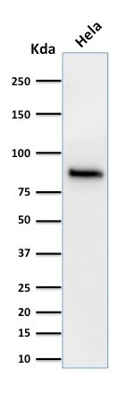 Catenin, beta (p120) Antibody in Western Blot (WB)