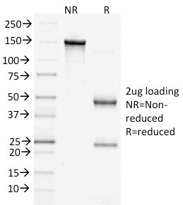 Catenin, beta (p120) Antibody in SDS-PAGE (SDS-PAGE)