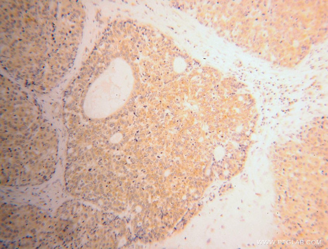 RPL39 Antibody in Immunohistochemistry (Paraffin) (IHC (P))