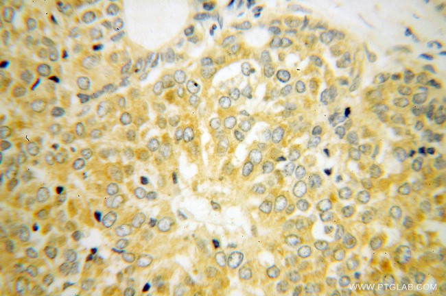 RPL39 Antibody in Immunohistochemistry (Paraffin) (IHC (P))