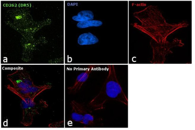 CD262 (DR5) Antibody in Immunocytochemistry (ICC/IF)