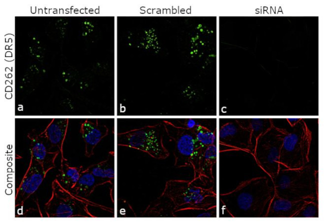 CD262 (DR5) Antibody in Immunocytochemistry (ICC/IF)