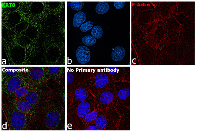 Cytokeratin 8 Antibody in Immunocytochemistry (ICC/IF)