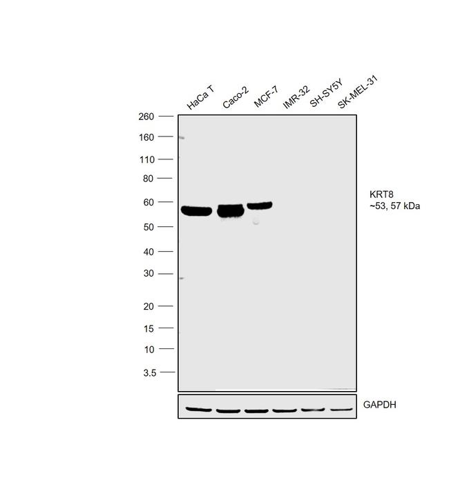 Cytokeratin 8 Antibody in Western Blot (WB)