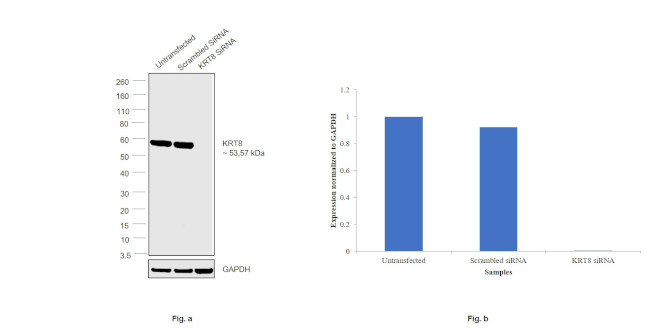 Cytokeratin 8 Antibody