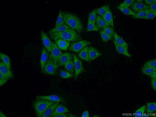 DDA1 Antibody in Immunocytochemistry (ICC/IF)