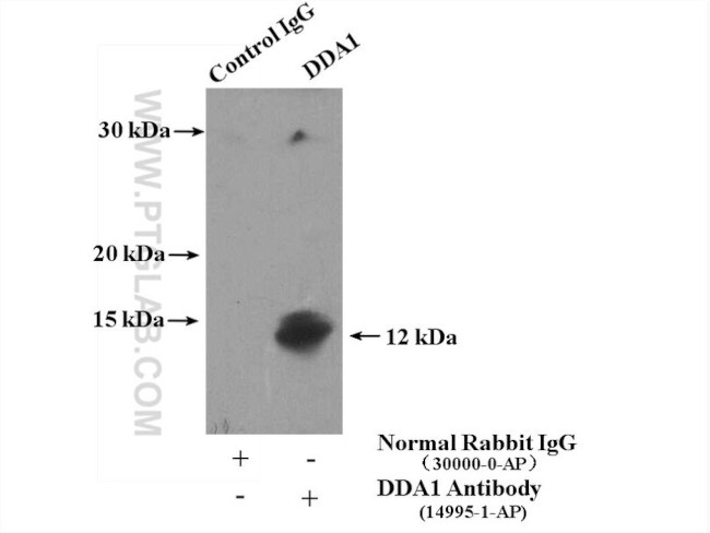 DDA1 Antibody in Immunoprecipitation (IP)