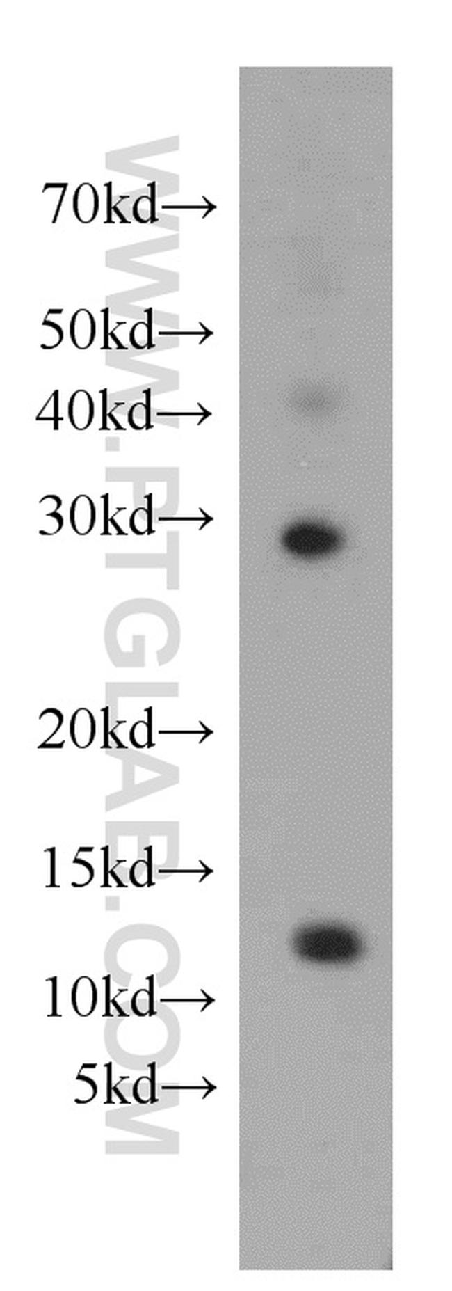 DDA1 Antibody in Western Blot (WB)