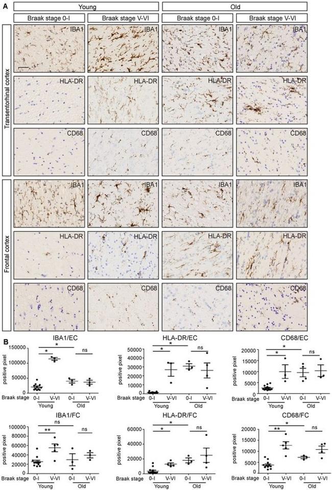 HLA-DR Antibody in Immunohistochemistry (IHC)