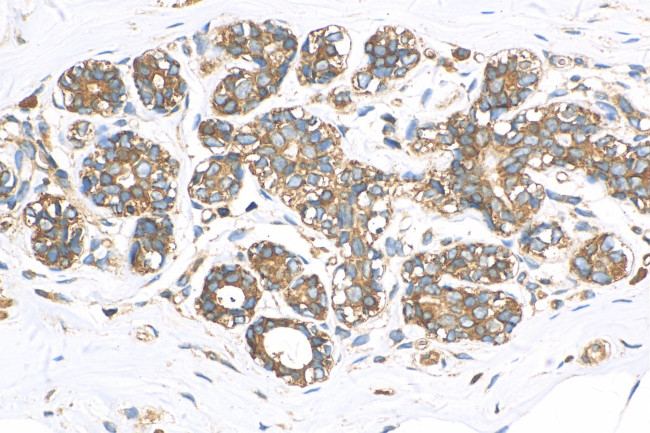 ABCB6 Antibody in Immunohistochemistry (Paraffin) (IHC (P))