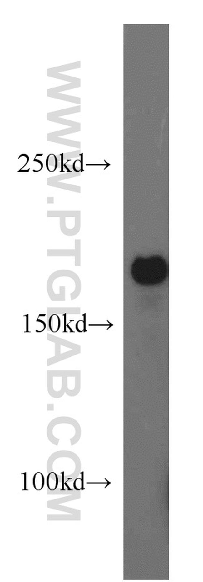 ABCB6 Antibody in Western Blot (WB)