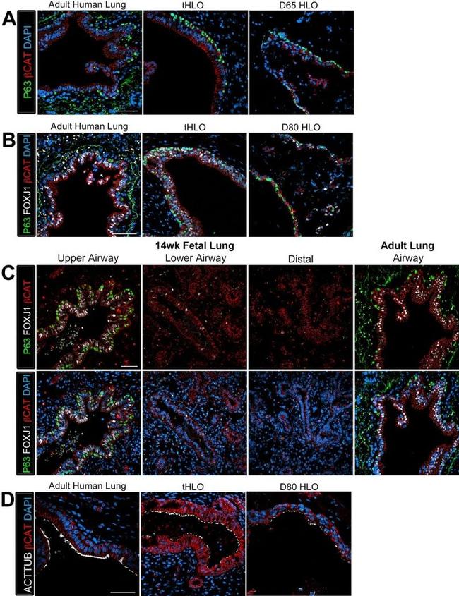 FOXJ1 Antibody in Immunohistochemistry (IHC)