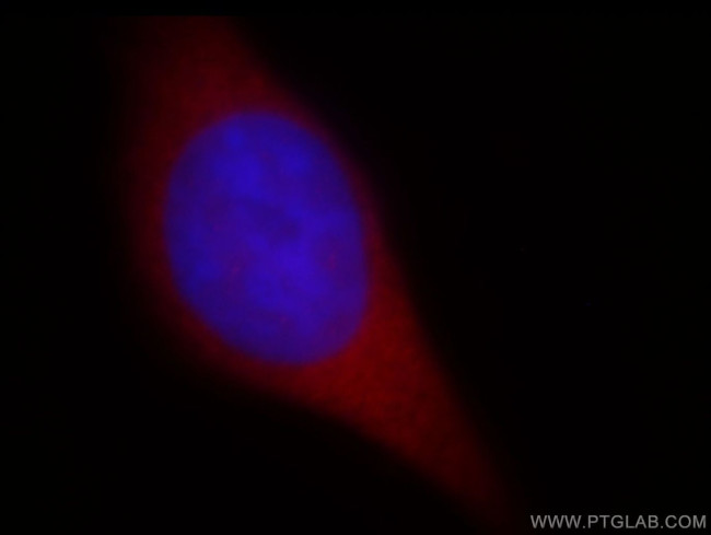 PDCL3 Antibody in Immunocytochemistry (ICC/IF)