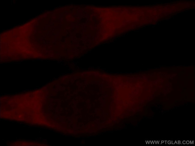 PDCL3 Antibody in Immunocytochemistry (ICC/IF)