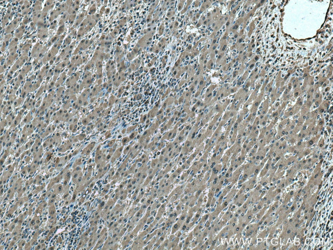 Thioredoxin Antibody in Immunohistochemistry (Paraffin) (IHC (P))