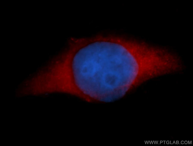 Thioredoxin Antibody in Immunocytochemistry (ICC/IF)