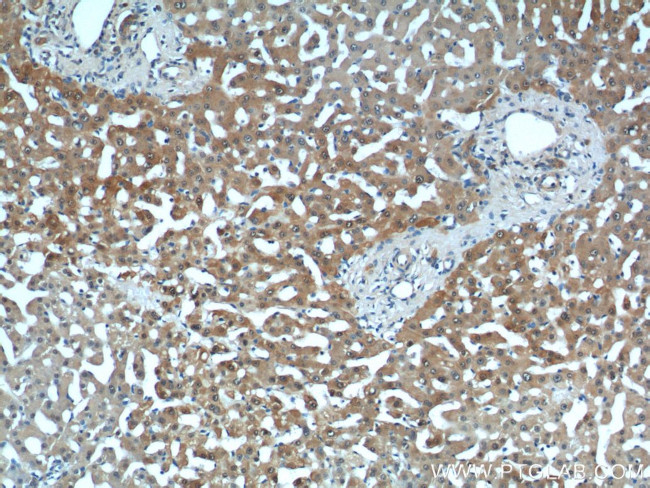 Thioredoxin Antibody in Immunohistochemistry (Paraffin) (IHC (P))