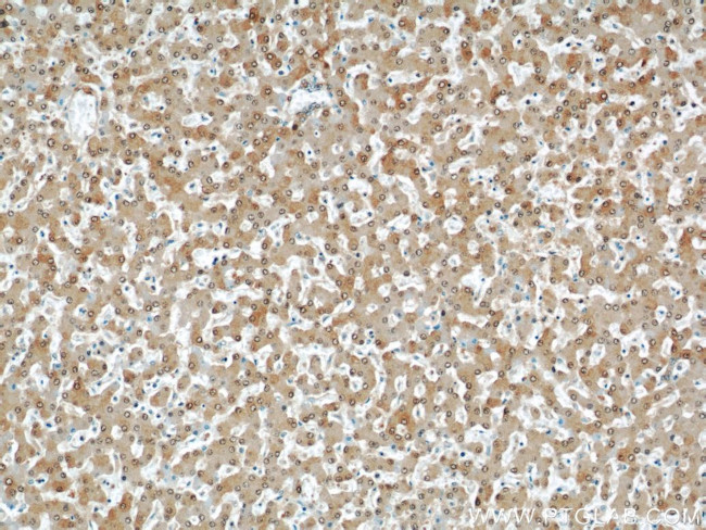 Thioredoxin Antibody in Immunohistochemistry (Paraffin) (IHC (P))