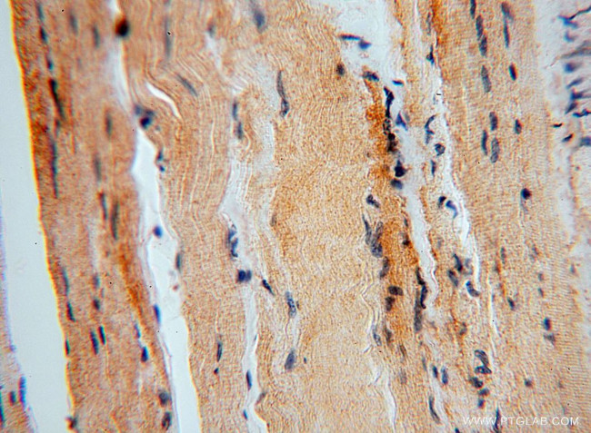 Thioredoxin Antibody in Immunohistochemistry (Paraffin) (IHC (P))