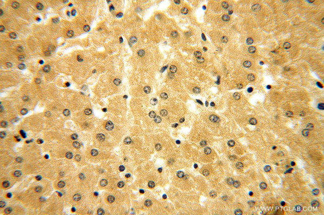 Thioredoxin Antibody in Immunohistochemistry (Paraffin) (IHC (P))