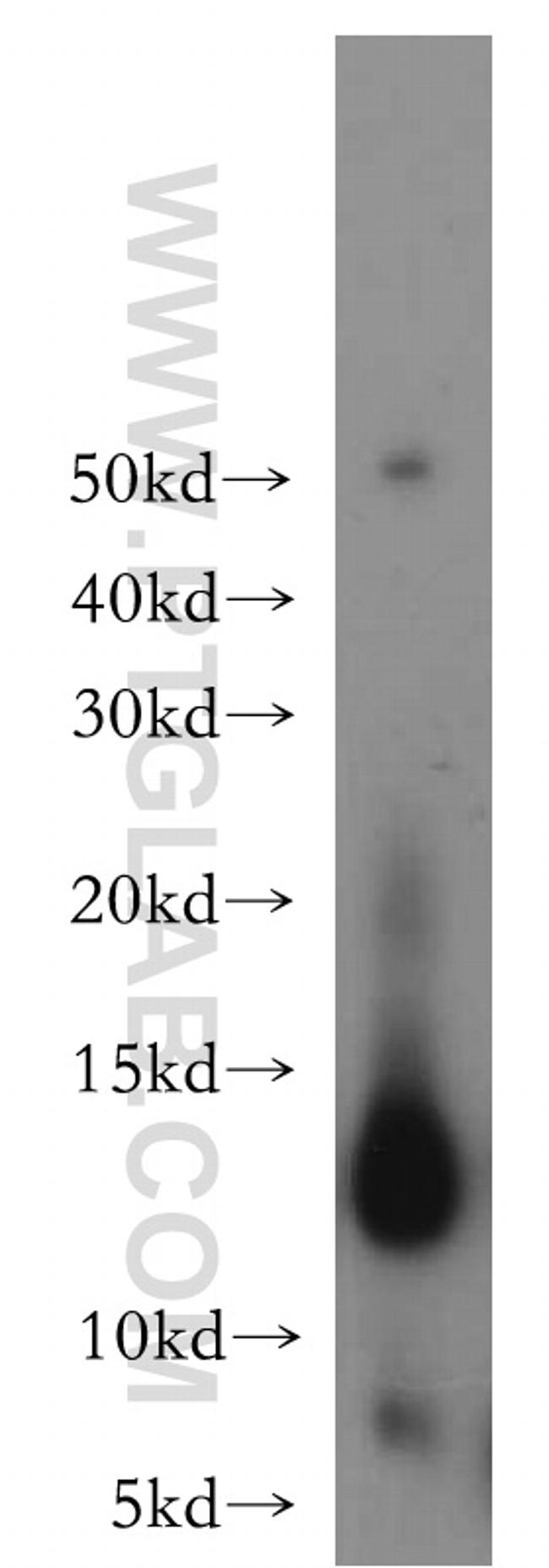 Thioredoxin Antibody in Western Blot (WB)