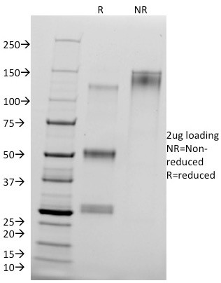 Catenin, delta-1 (CTNND1) (pTyr96) Antibody in SDS-PAGE (SDS-PAGE)