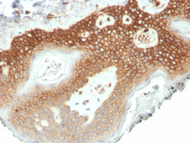 p120/Catenin, delta-1 (CTNND1) Antibody in Immunohistochemistry (Paraffin) (IHC (P))