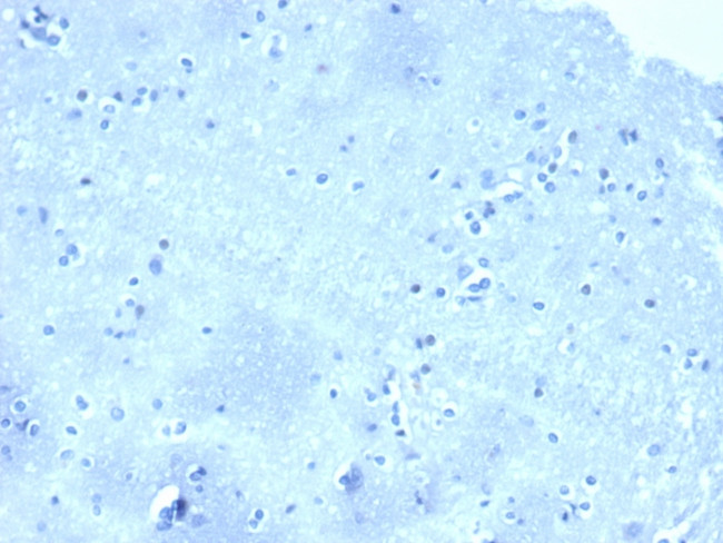 p120/Catenin, delta-1 (CTNND1) Antibody in Immunohistochemistry (Paraffin) (IHC (P))