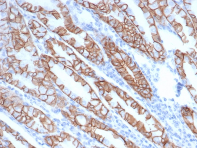 p120/Catenin, delta-1 (CTNND1) Antibody in Immunohistochemistry (Paraffin) (IHC (P))