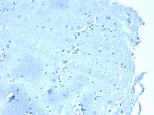 p120/Catenin, delta-1 (CTNND1) Antibody in Immunohistochemistry (Paraffin) (IHC (P))