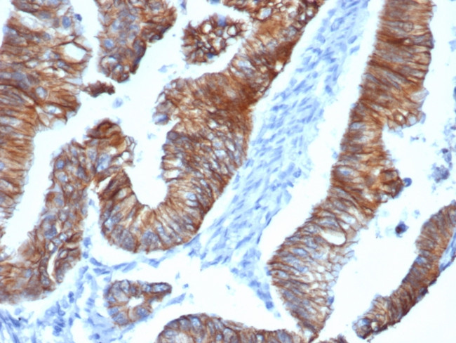 p120/Catenin, delta-1 (CTNND1) Antibody in Immunohistochemistry (Paraffin) (IHC (P))