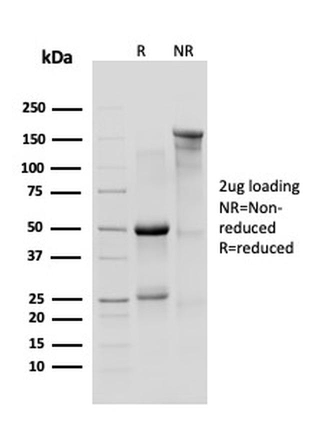p120/Catenin, delta-1 (CTNND1) Antibody in SDS-PAGE (SDS-PAGE)