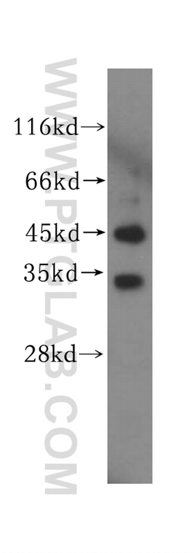 UNKL Antibody in Western Blot (WB)