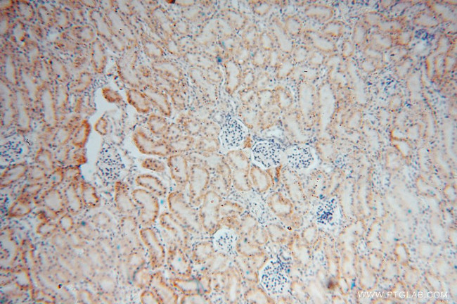 RENALASE Antibody in Immunohistochemistry (Paraffin) (IHC (P))