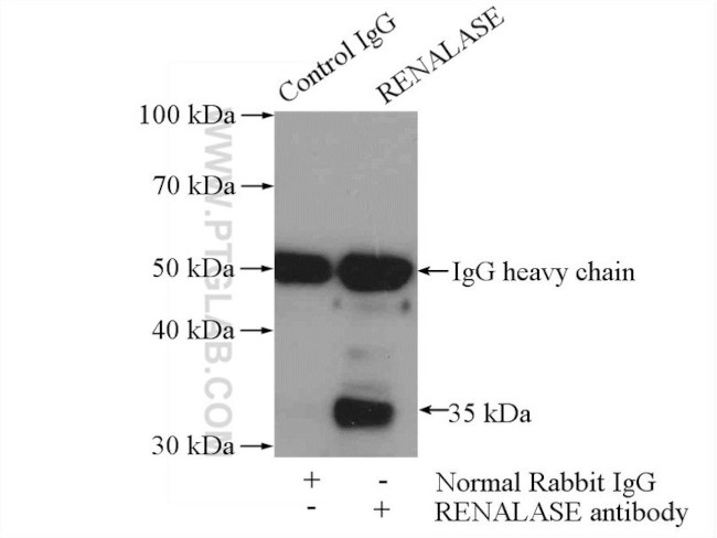 RENALASE Antibody in Immunoprecipitation (IP)