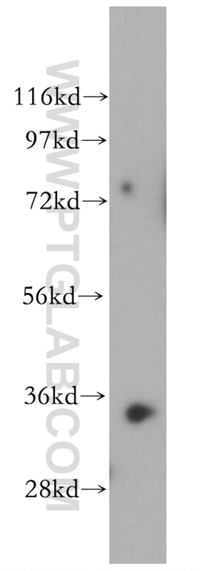 RENALASE Antibody in Western Blot (WB)