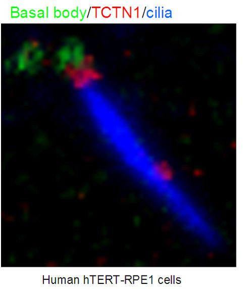 TCTN1 Antibody in Immunocytochemistry (ICC/IF)