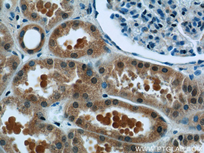 TCTN1 Antibody in Immunohistochemistry (Paraffin) (IHC (P))