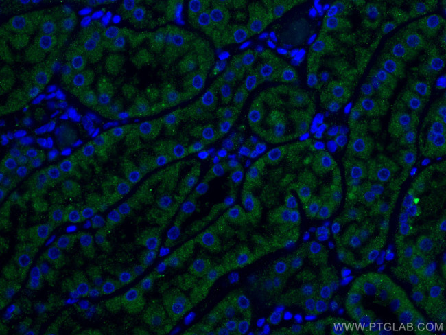 TCTN1 Antibody in Immunohistochemistry (PFA fixed) (IHC (PFA))