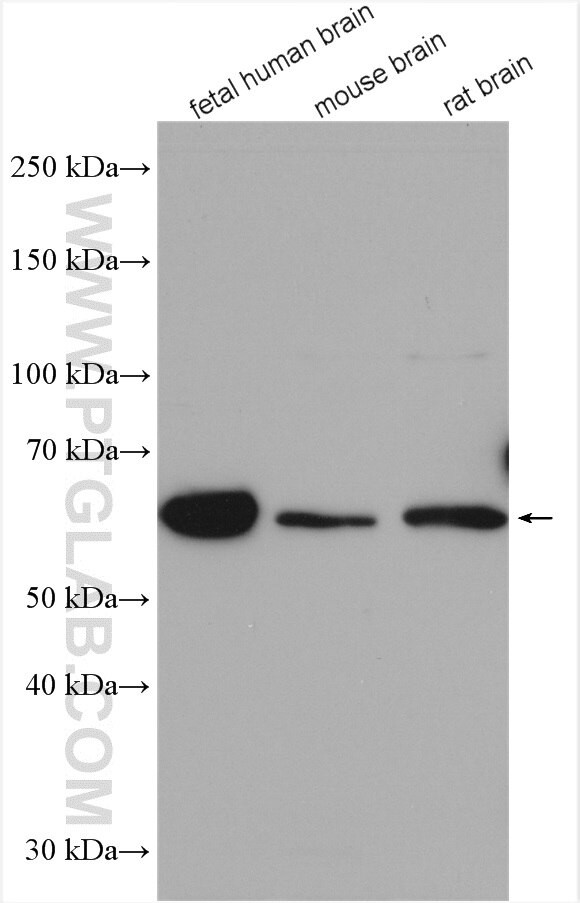 TCTN1 Antibody in Western Blot (WB)