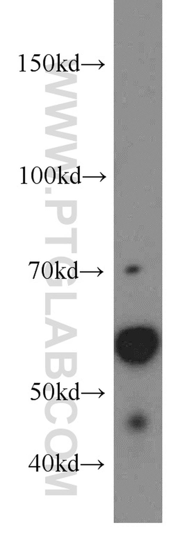 ARIH2 Antibody in Western Blot (WB)